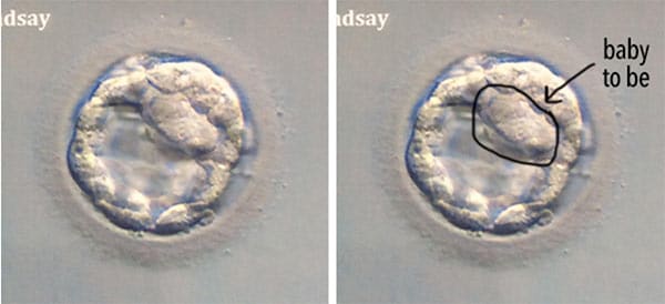 Two Photos of Lindsay's Embryo
